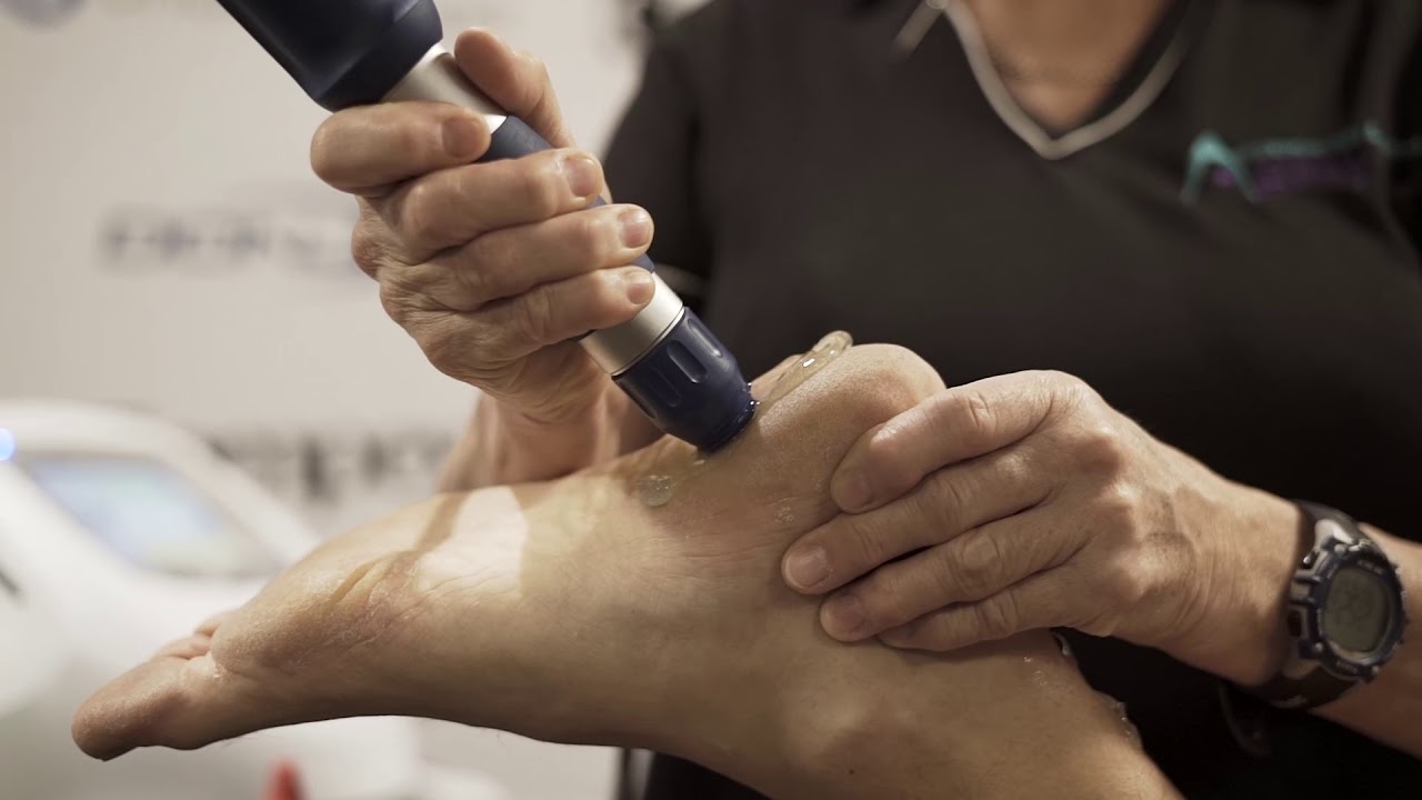 Shockwave Therapy for Tendinopathies - Agility Physiotherapy and Pilates